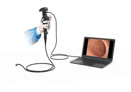 Revolutionizing Medical Procedures: The Cutting-Edge USB Scopes